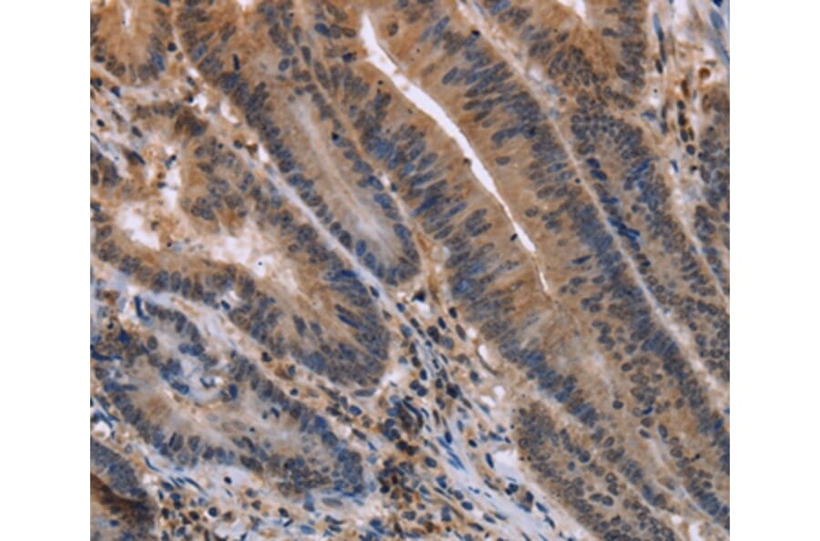 Immunohistochemistry - ETV7 Antibody from Signalway Antibody (36452) - Antibodies.com