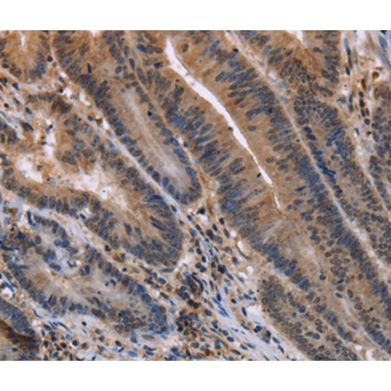 Immunohistochemistry - ETV7 Antibody from Signalway Antibody (36452) - Antibodies.com