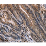 Immunohistochemistry - ETV7 Antibody from Signalway Antibody (36452) - Antibodies.com