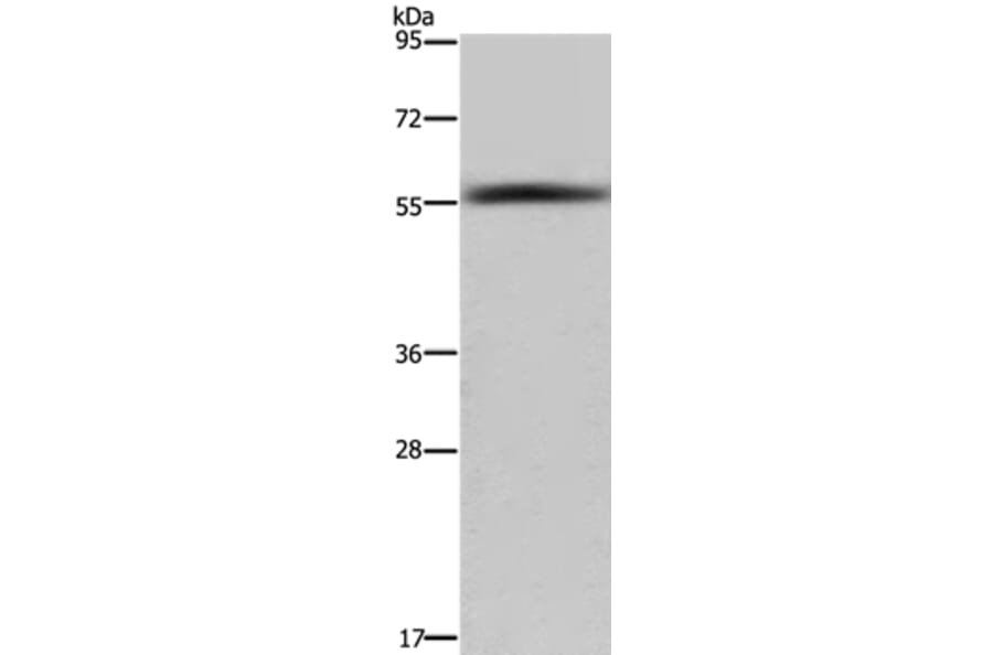 FAR2 Antibody from Signalway Antibody (36466) - Antibodies.com