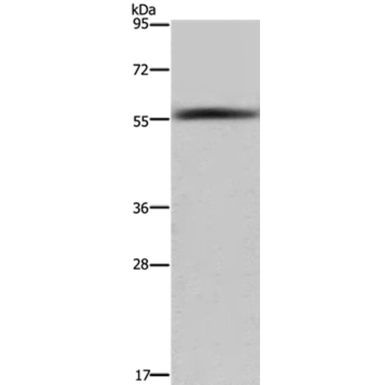 FAR2 Antibody from Signalway Antibody (36466) - Antibodies.com