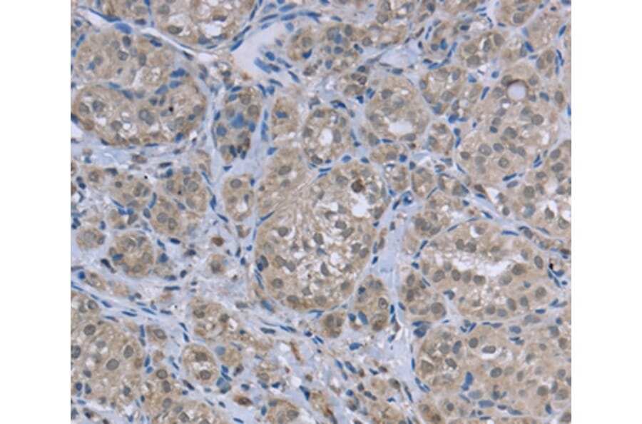 Immunohistochemistry - FAR2 Antibody from Signalway Antibody (36466) - Antibodies.com