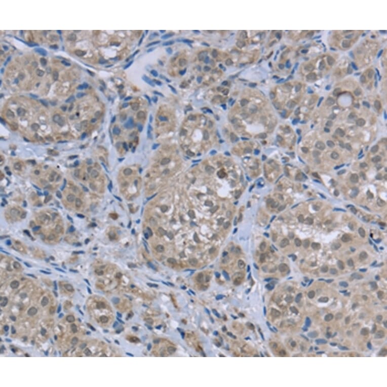 Immunohistochemistry - FAR2 Antibody from Signalway Antibody (36466) - Antibodies.com