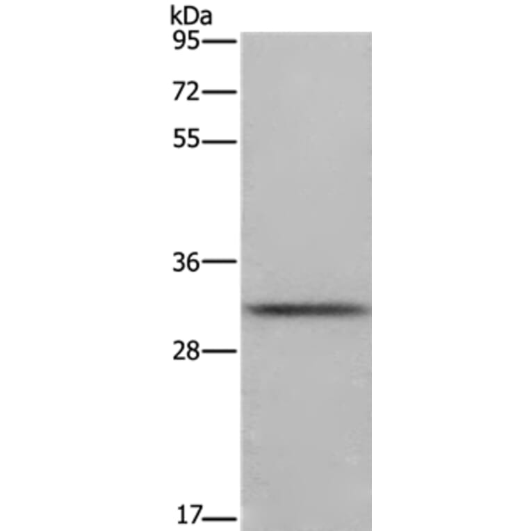 FCAR Antibody from Signalway Antibody (36474) - Antibodies.com