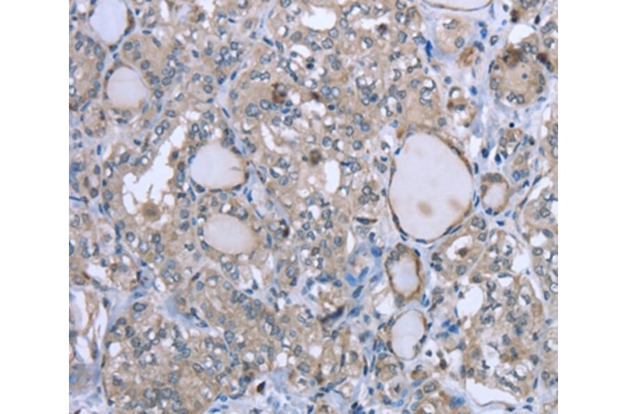 Immunohistochemistry - FCAR Antibody from Signalway Antibody (36474) - Antibodies.com
