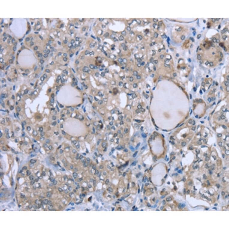 Immunohistochemistry - FCAR Antibody from Signalway Antibody (36474) - Antibodies.com
