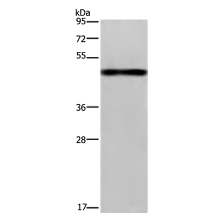 FGL2 Antibody from Signalway Antibody (36481) - Antibodies.com