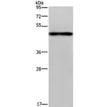 FGL2 Antibody from Signalway Antibody (36481) - Antibodies.com