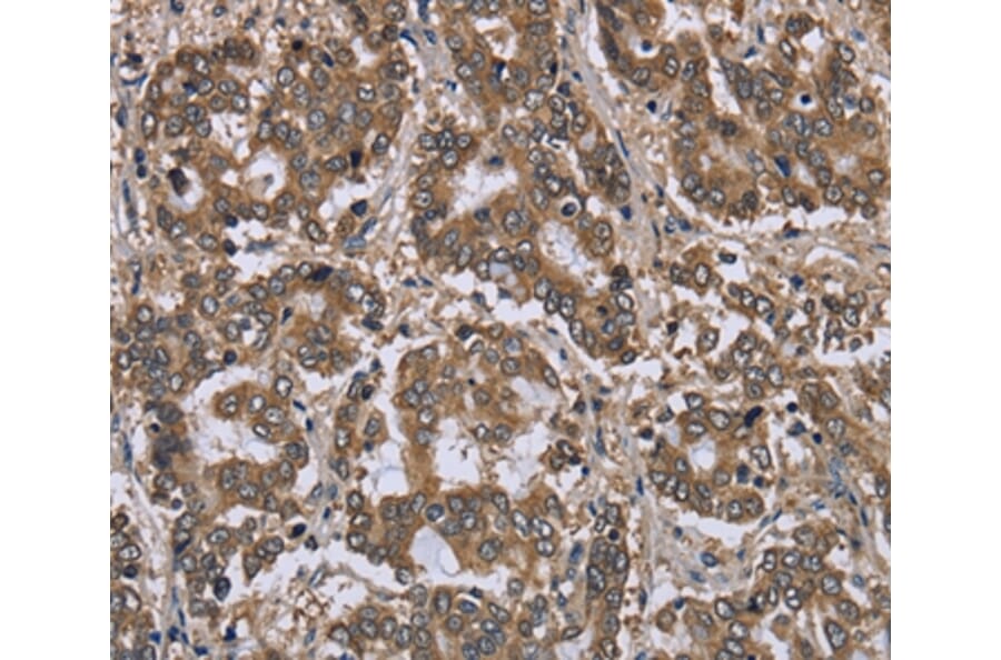 Immunohistochemistry - FGL2 Antibody from Signalway Antibody (36481) - Antibodies.com