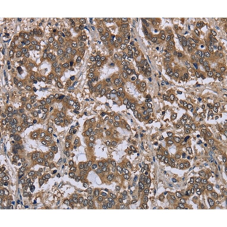 Immunohistochemistry - FGL2 Antibody from Signalway Antibody (36481) - Antibodies.com