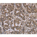 Immunohistochemistry - FGL2 Antibody from Signalway Antibody (36481) - Antibodies.com