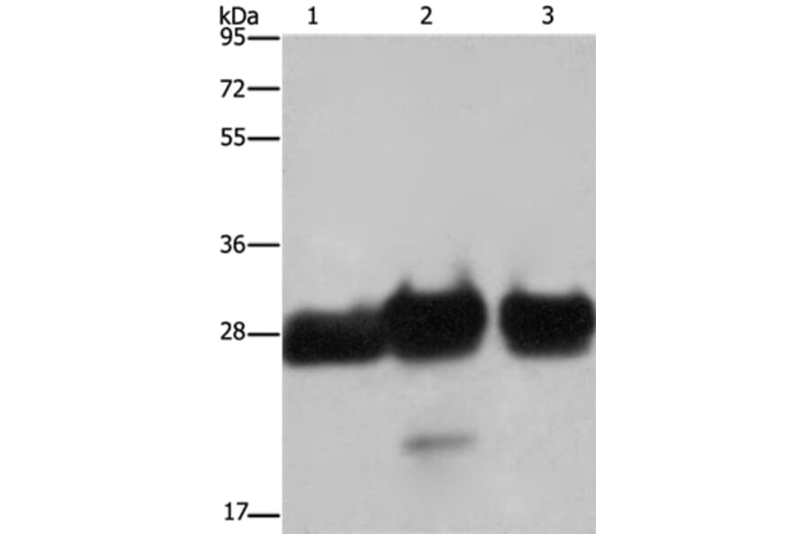 FHL1 Antibody from Signalway Antibody (36482) - Antibodies.com