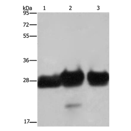 FHL1 Antibody from Signalway Antibody (36482) - Antibodies.com