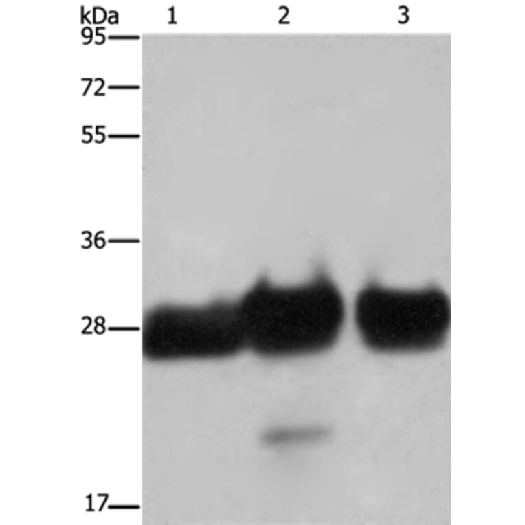 FHL1 Antibody from Signalway Antibody (36482) - Antibodies.com