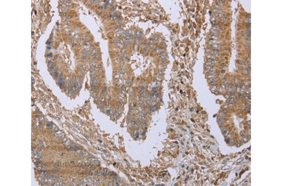 Immunohistochemistry - FHL1 Antibody from Signalway Antibody (36482) - Antibodies.com