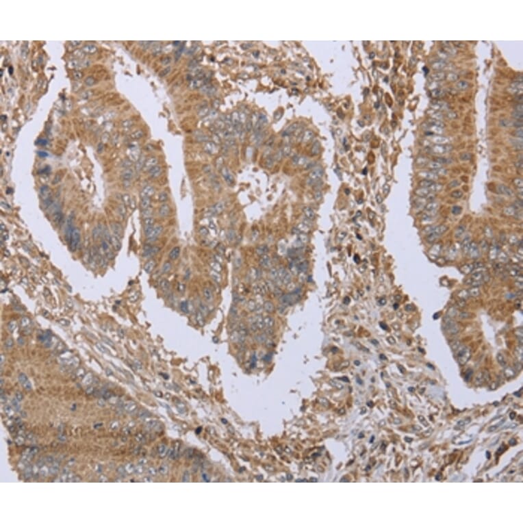 Immunohistochemistry - FHL1 Antibody from Signalway Antibody (36482) - Antibodies.com