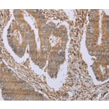 Immunohistochemistry - FHL1 Antibody from Signalway Antibody (36482) - Antibodies.com