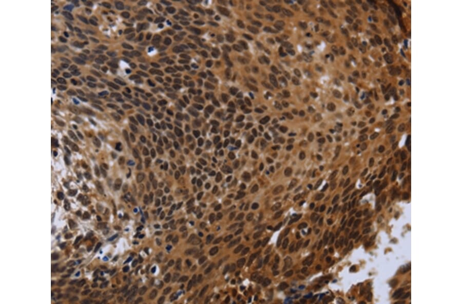 Immunohistochemistry - FHL3 Antibody from Signalway Antibody (36483) - Antibodies.com