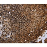Immunohistochemistry - FHL3 Antibody from Signalway Antibody (36483) - Antibodies.com