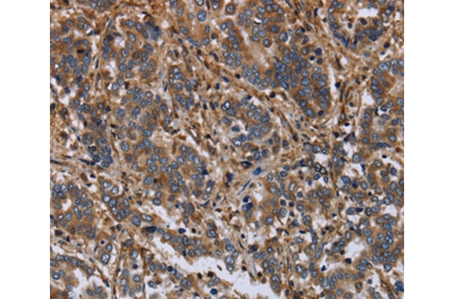 Immunohistochemistry - FLNA Antibody from Signalway Antibody (36484) - Antibodies.com