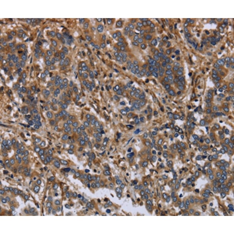 Immunohistochemistry - FLNA Antibody from Signalway Antibody (36484) - Antibodies.com