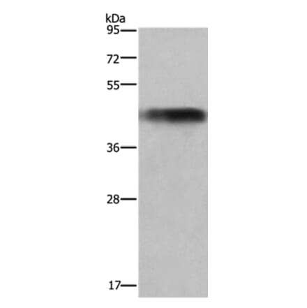 GALT Antibody from Signalway Antibody (36494) - Antibodies.com