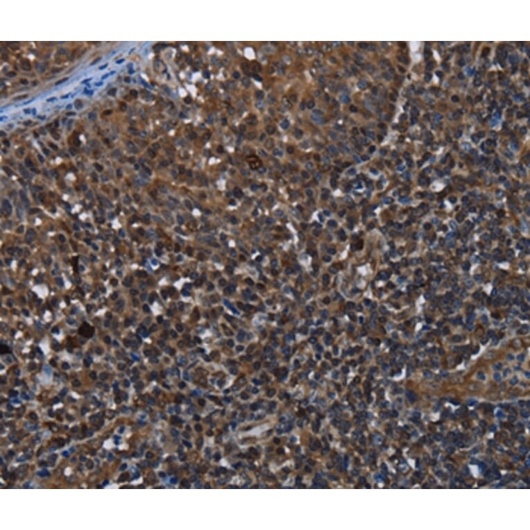 Immunohistochemistry - GALT Antibody from Signalway Antibody (36494) - Antibodies.com