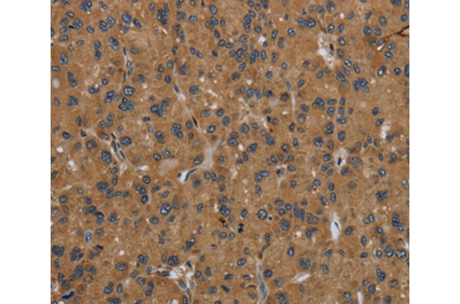 Immunohistochemistry - GBP5 Antibody from Signalway Antibody (36497) - Antibodies.com