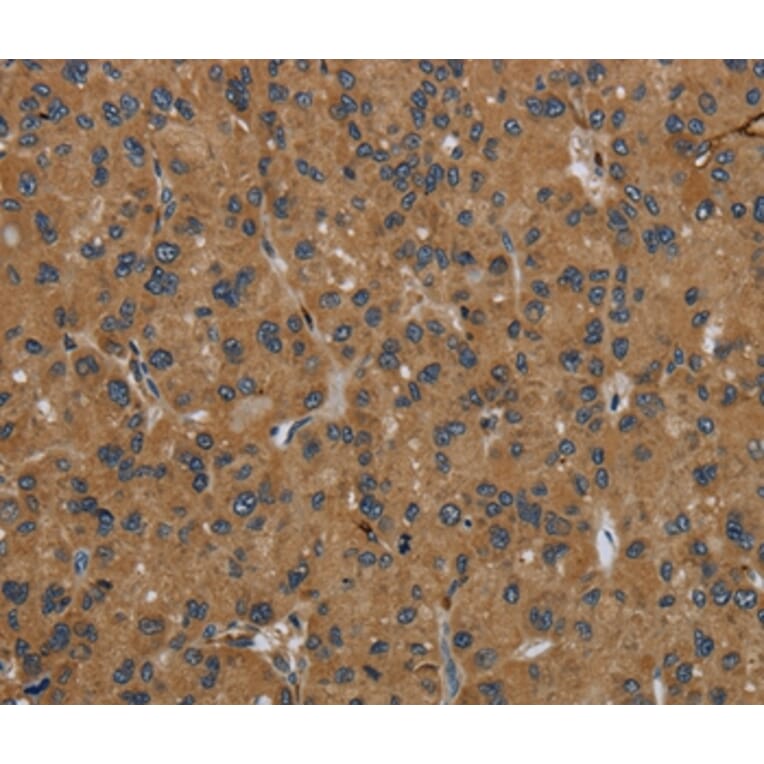 Immunohistochemistry - GBP5 Antibody from Signalway Antibody (36497) - Antibodies.com
