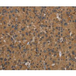 Immunohistochemistry - GBP5 Antibody from Signalway Antibody (36497) - Antibodies.com