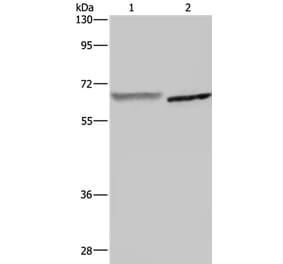 GCKR Antibody from Signalway Antibody (36500) - Antibodies.com