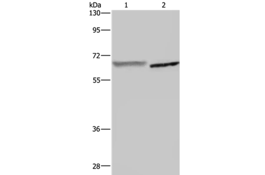 GCKR Antibody from Signalway Antibody (36500) - Antibodies.com