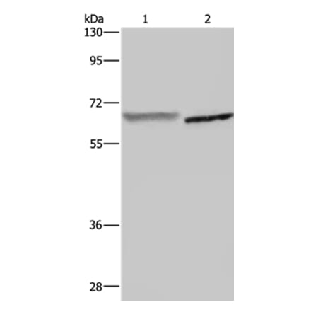 GCKR Antibody from Signalway Antibody (36500) - Antibodies.com