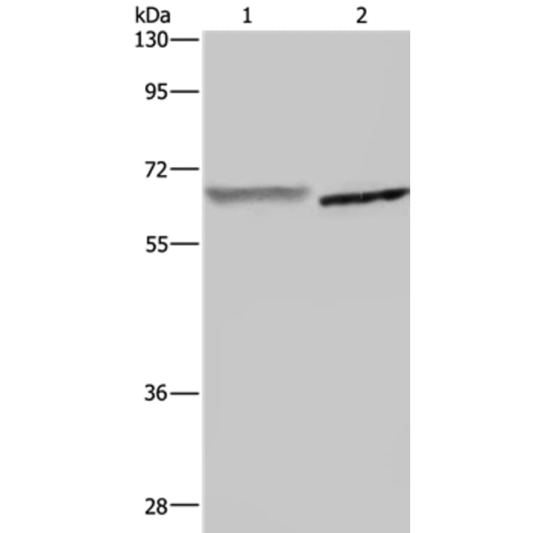 GCKR Antibody from Signalway Antibody (36500) - Antibodies.com