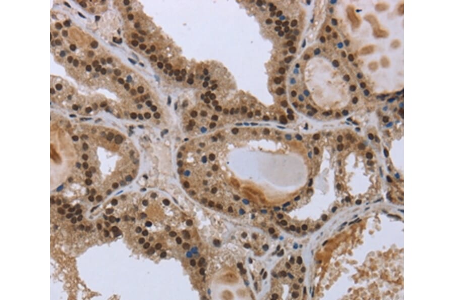 Immunohistochemistry - GCKR Antibody from Signalway Antibody (36500) - Antibodies.com