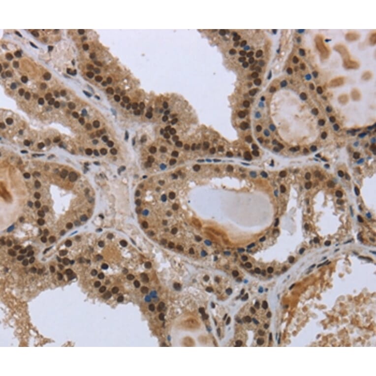Immunohistochemistry - GCKR Antibody from Signalway Antibody (36500) - Antibodies.com
