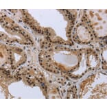 Immunohistochemistry - GCKR Antibody from Signalway Antibody (36500) - Antibodies.com