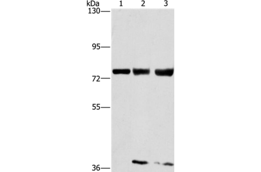GGCX Antibody from Signalway Antibody (36501) - Antibodies.com