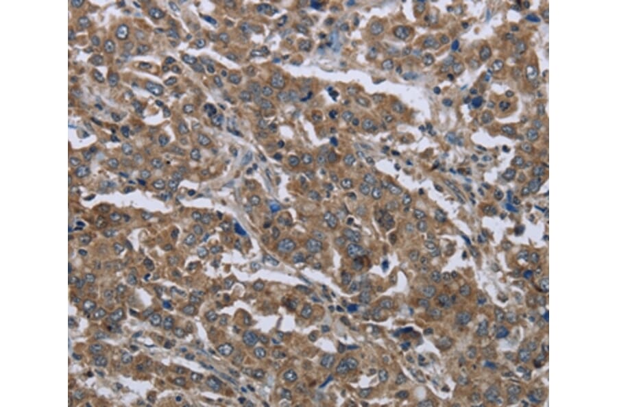 Immunohistochemistry - GGCX Antibody from Signalway Antibody (36501) - Antibodies.com