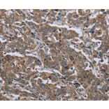 Immunohistochemistry - GGCX Antibody from Signalway Antibody (36501) - Antibodies.com