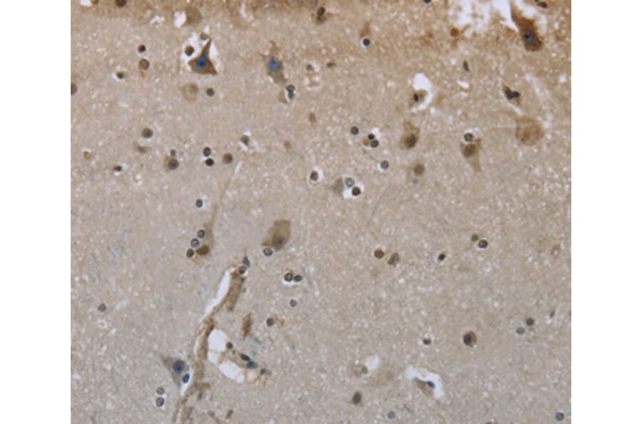 IHC of FFPE human brain stained with rabbit anti-Glycogen synthase Antibody (A38741)