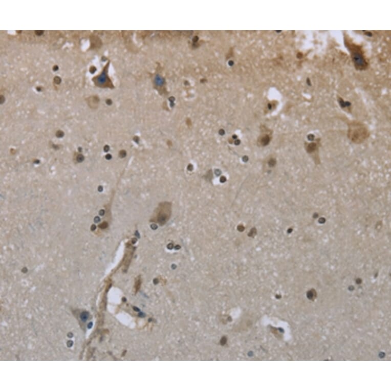 Immunohistochemistry - GYS1 Antibody from Signalway Antibody (36508) - Antibodies.com