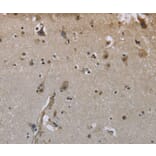 Immunohistochemistry - GYS1 Antibody from Signalway Antibody (36508) - Antibodies.com