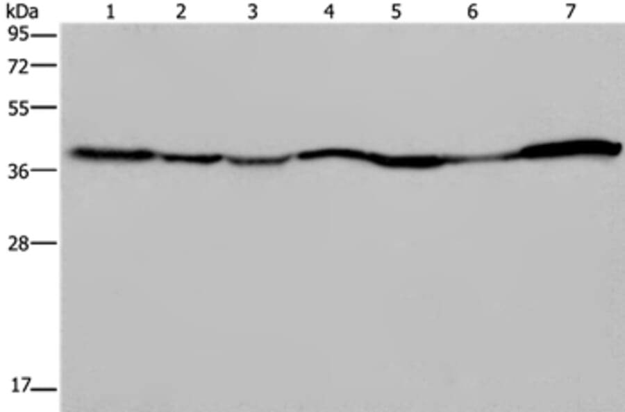 GOT2 Antibody from Signalway Antibody (36511) - Antibodies.com