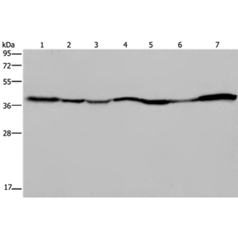 GOT2 Antibody from Signalway Antibody (36511) - Antibodies.com
