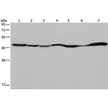 GOT2 Antibody from Signalway Antibody (36511) - Antibodies.com