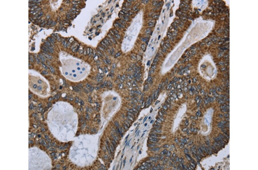Immunohistochemistry - GOT2 Antibody from Signalway Antibody (36511) - Antibodies.com