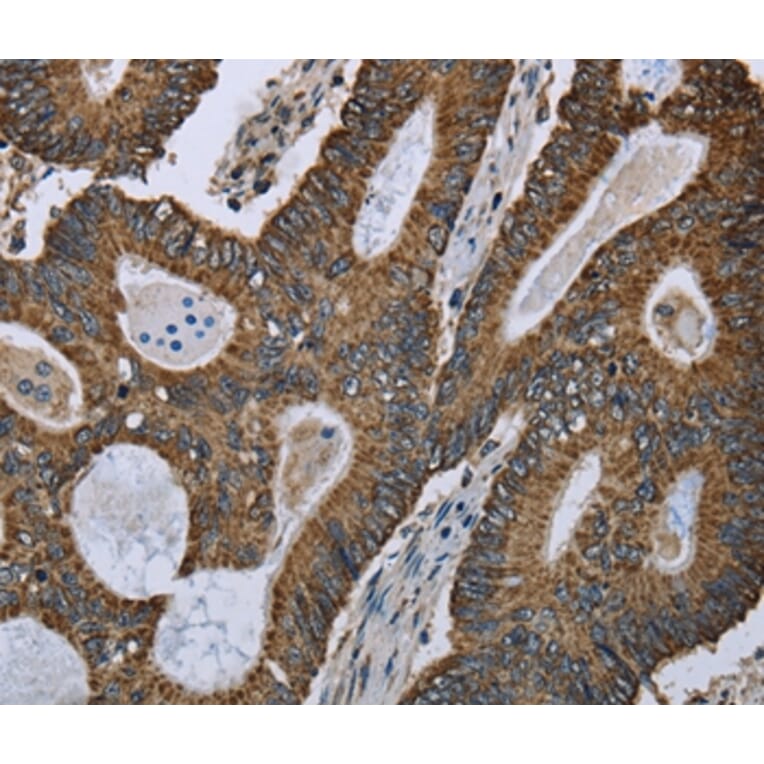 Immunohistochemistry - GOT2 Antibody from Signalway Antibody (36511) - Antibodies.com
