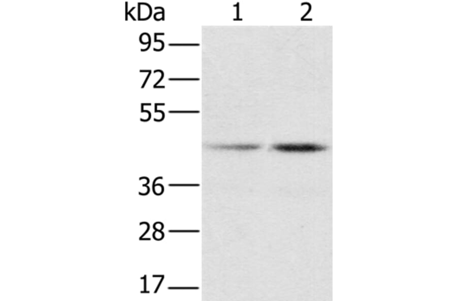 RBMX Antibody from Signalway Antibody (36522) - Antibodies.com