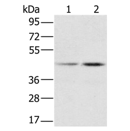RBMX Antibody from Signalway Antibody (36522) - Antibodies.com